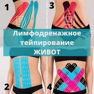 Тейпирование тела для похудения