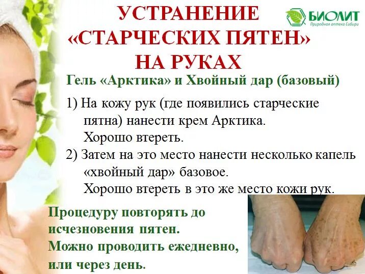 Избавиться от пигментных пятен навсегда. Народные средства от пигментации. избавление от пигментных пятен. избавление от пигментации на лице. средство от пигментных пятен на руках.