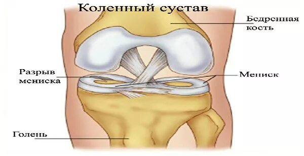 Боль в коленном суставе, причины, симптомы, этиология, патогенез, методы лечения