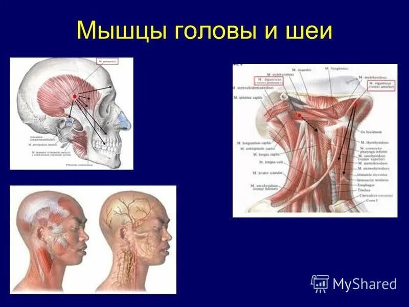 Болит голова и мышцы шеи. Основные мышцы головы и шеи. Функции мышц головы и шеи.