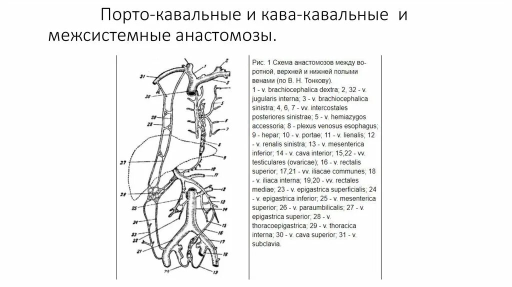 Воротная вена, порто-кавальные и кава-кавальные анастомозы. Порто портальный. Межсистемные венозные анастомозы. Нижняя брыжеечная вена анастомозы. Порто портальный.