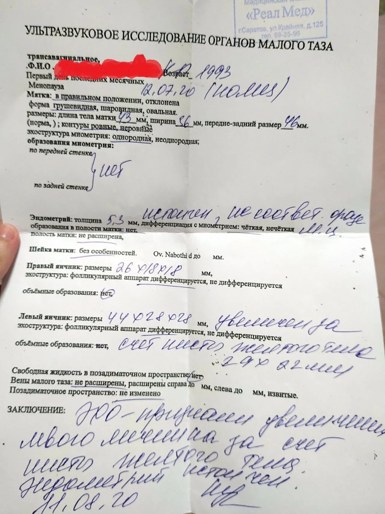 Почему нет выделений перед месячными. Почему нет выделений перед месячными