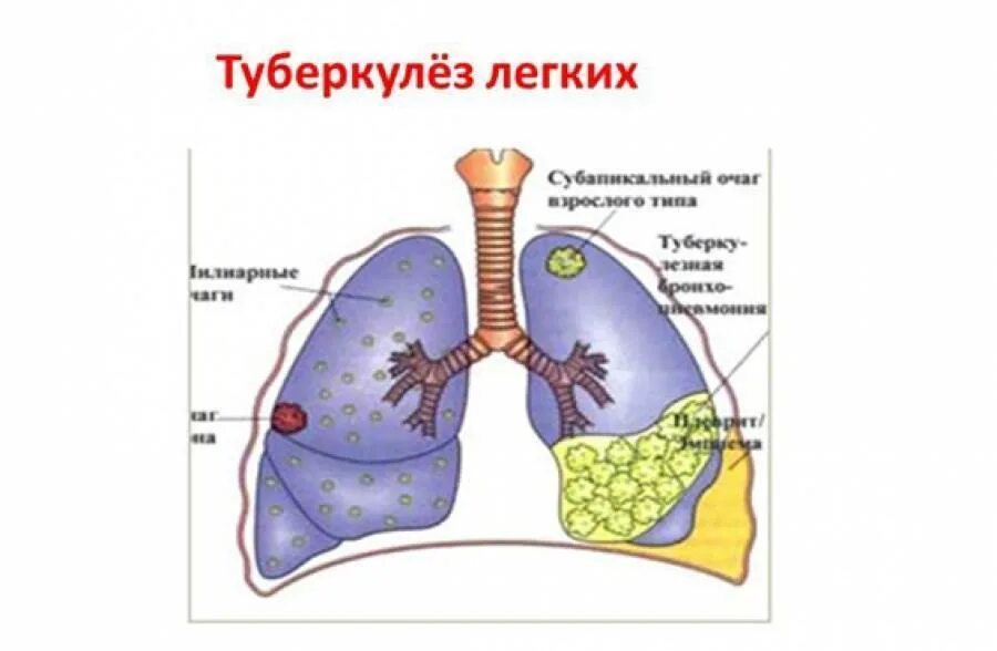 Очаг симон. Очаг симон