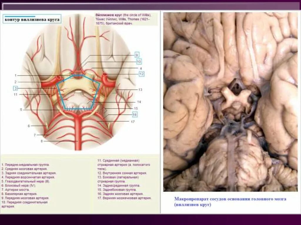Виллизиев круг сосуды. Артерии мозга Виллизиев круг. Варианты строения Виллизиева круга мрт. Виллизиев круг в головном мозге. Варианты развития Виллизиева круга на мрт.