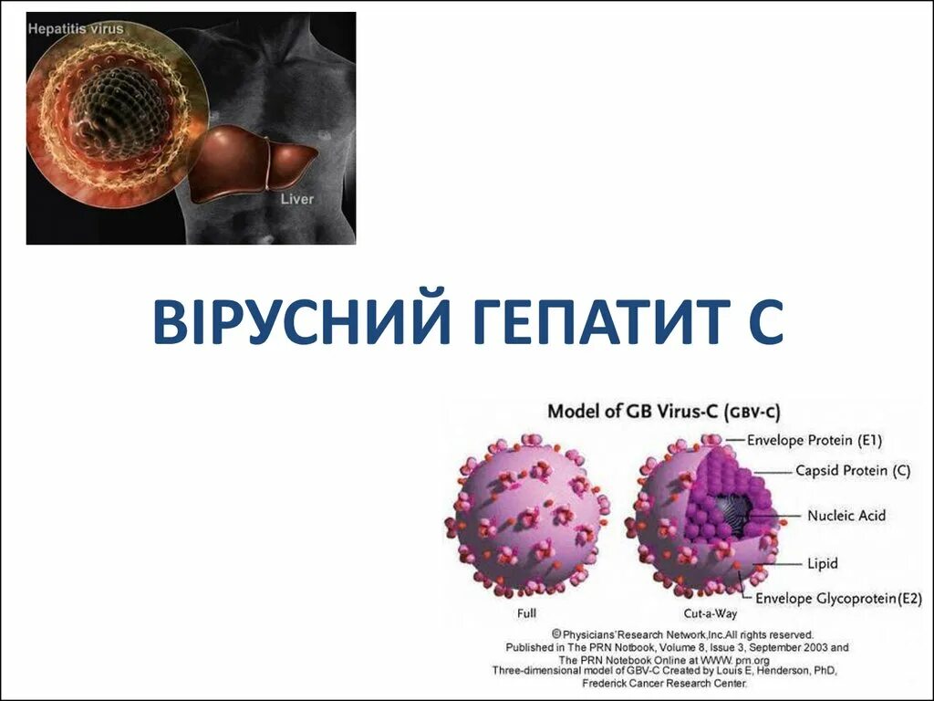 Вирусные гепатиты. Презентация на тему гепатит. Вірусний гепатит а.