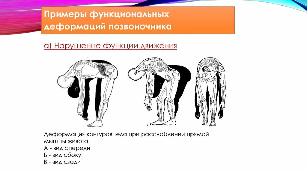 Нарушение функций движения