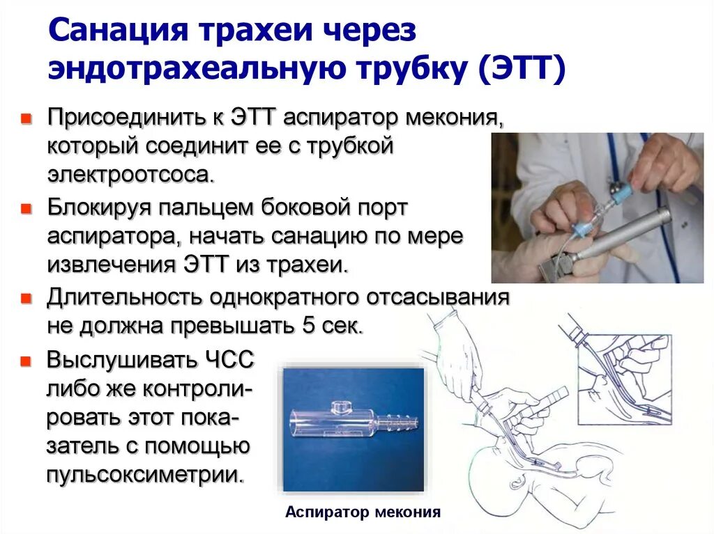 Санация эндотрахеальной трубки алгоритм. Санация трахеи электроотсосом\. Санация трахеи через интубационную трубку. Уход за трахеостомой алгоритм сестринское дело