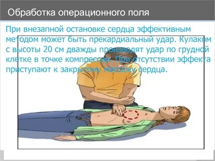 Компрессии на грудину взрослого человека необходимо