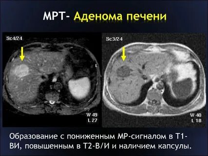Мрт печени где можно сделать