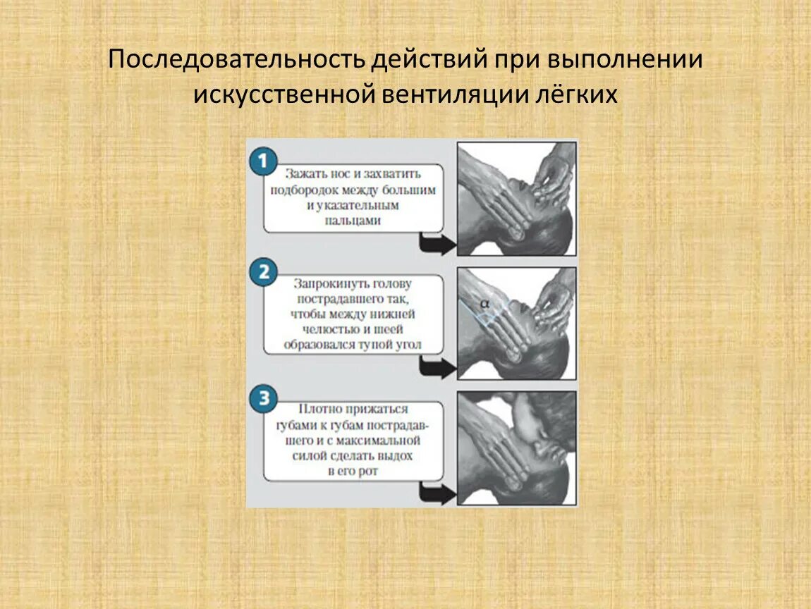 Последовательность проведения искусственной вентиляции легких. Последовательность действий при выполнении ИВЛ. Последовательность действий при вентиляции легких. Последовательность действий при искусственной вентиляции легких.