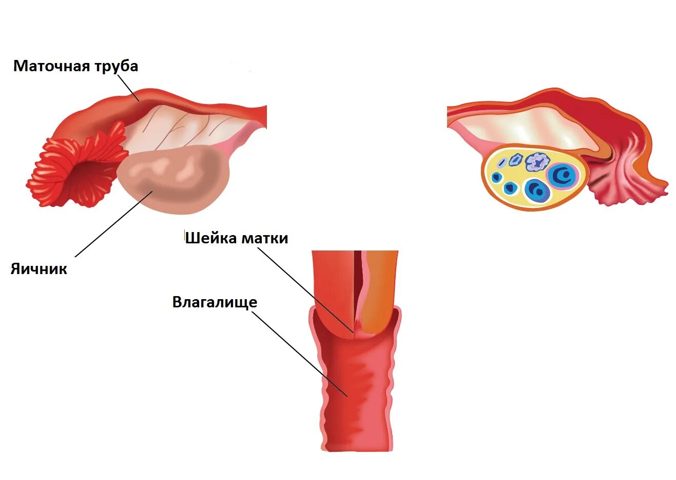 Удаление тела матки