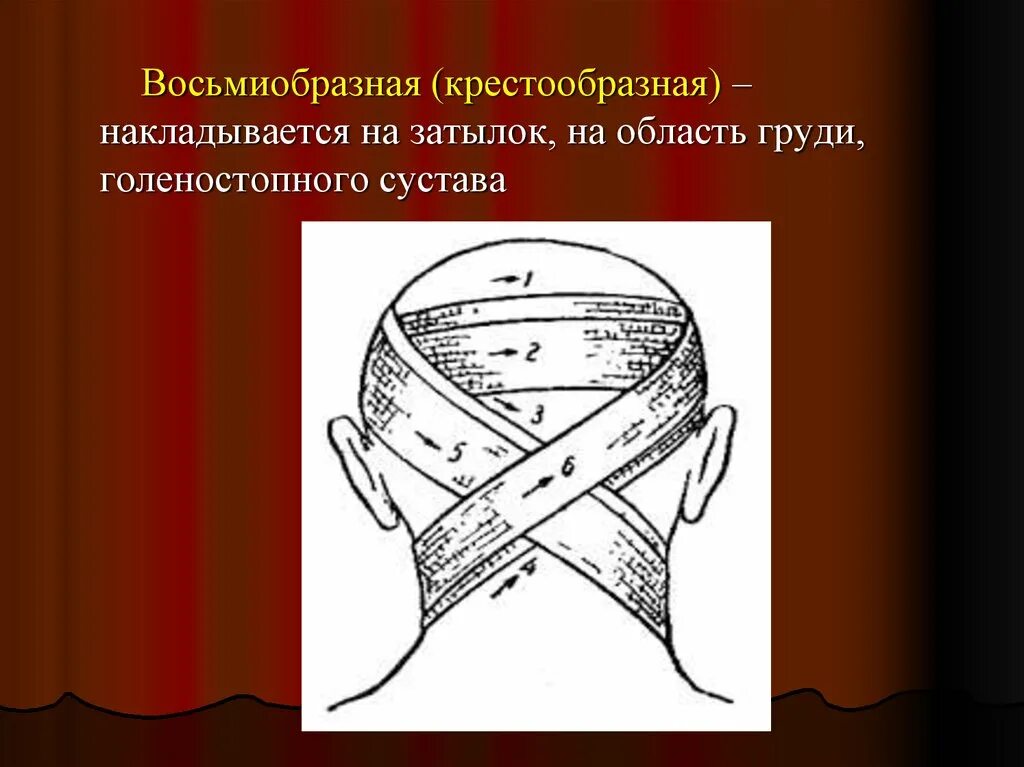 Крестообразная на затылок. Десмургия повязка восьмиобразная на голеностопный сустав. Крестообразная (восьмиобразная) повязка. Крестообразная (восьмиобразная). Восмеобразное перевязка.