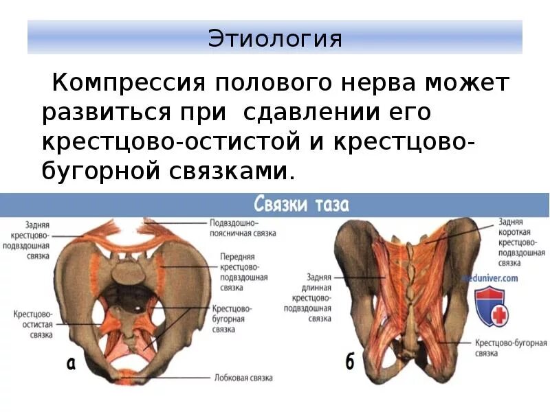 Грушевидная мышца срамной нерв. Анатомия полового нерва.