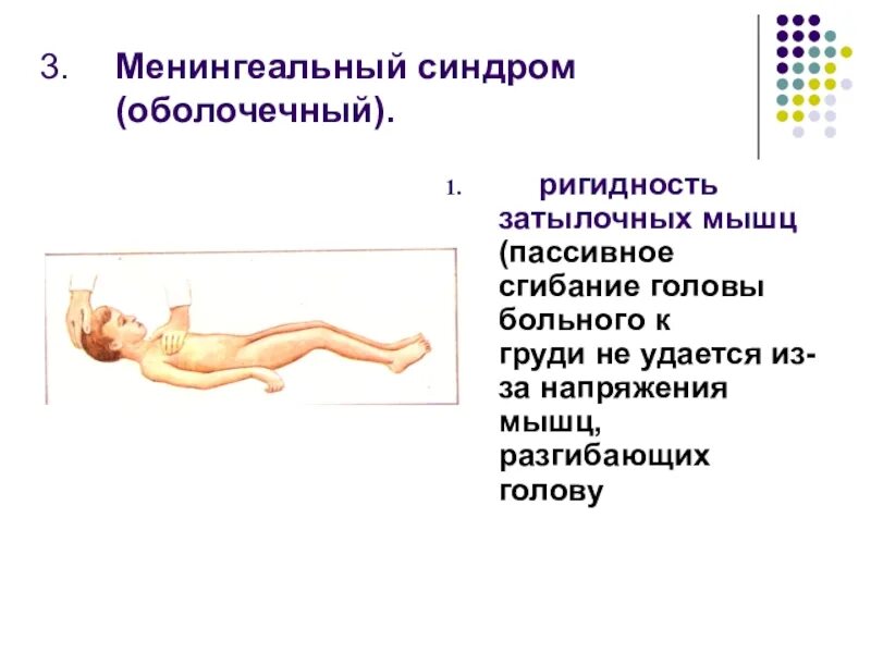 Тест на менингит. Менингеальный синдром неврология. Ригидность мышц затылка, симптомы Кернига, Брудзинского. Менингеальный синдром при менингите. Симптом Гордона менингеальный.