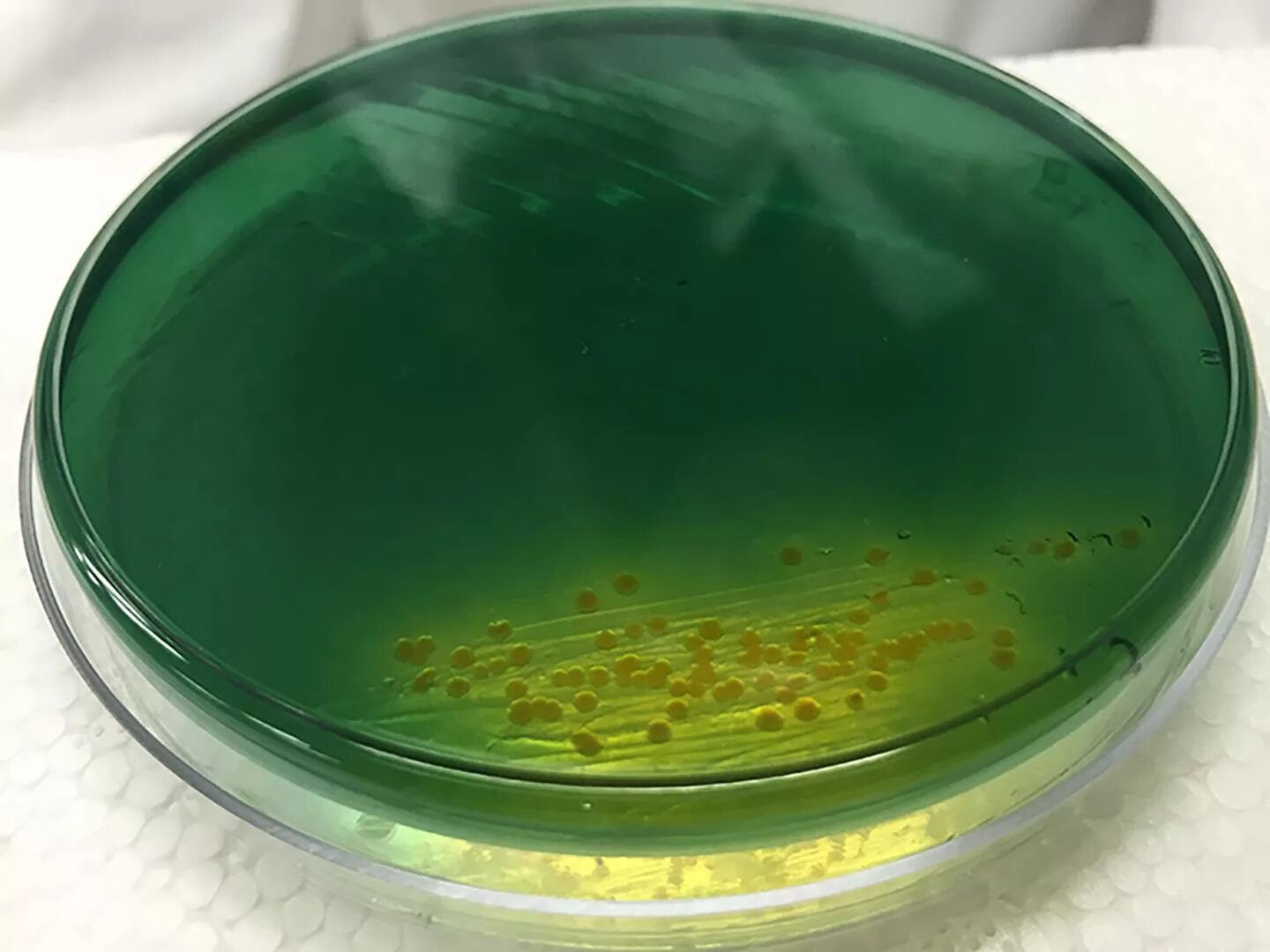 Твердые водоросли. Холерный вибрион на чашке Петри. Vibrio cholerae на чашке Петри. Мясопептонный агар (МПА). Лактозный агар с тергитолом 7.