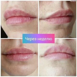 Дермалакс отзывы