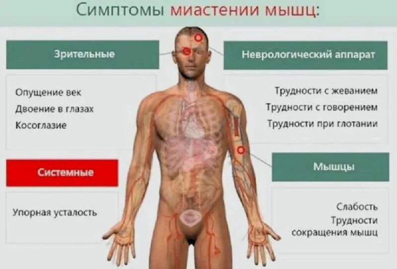 Центральная слабость