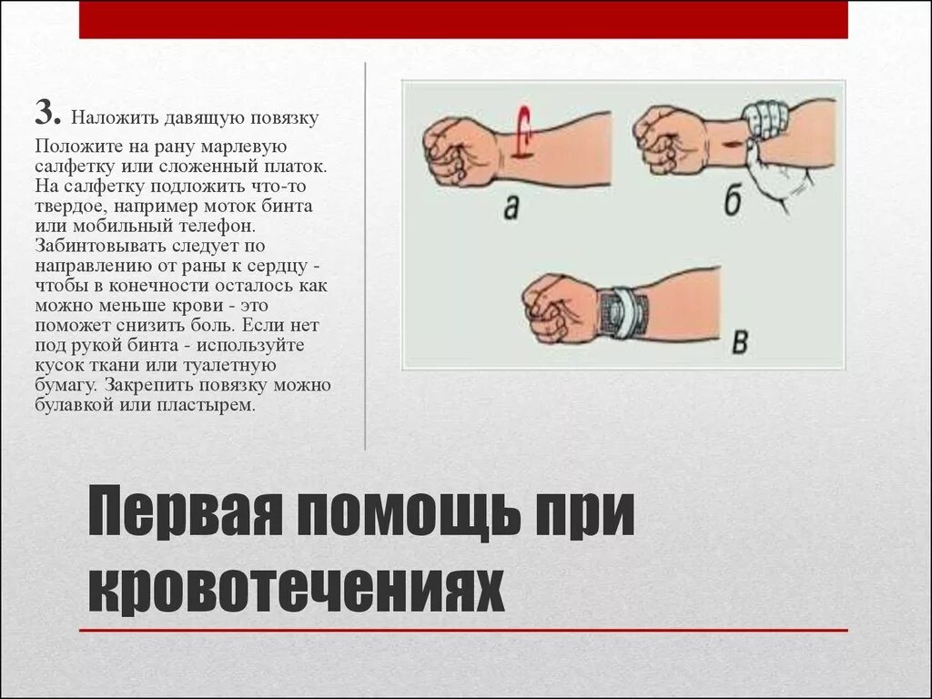 Техника наложения давящей повязки при кровотечении