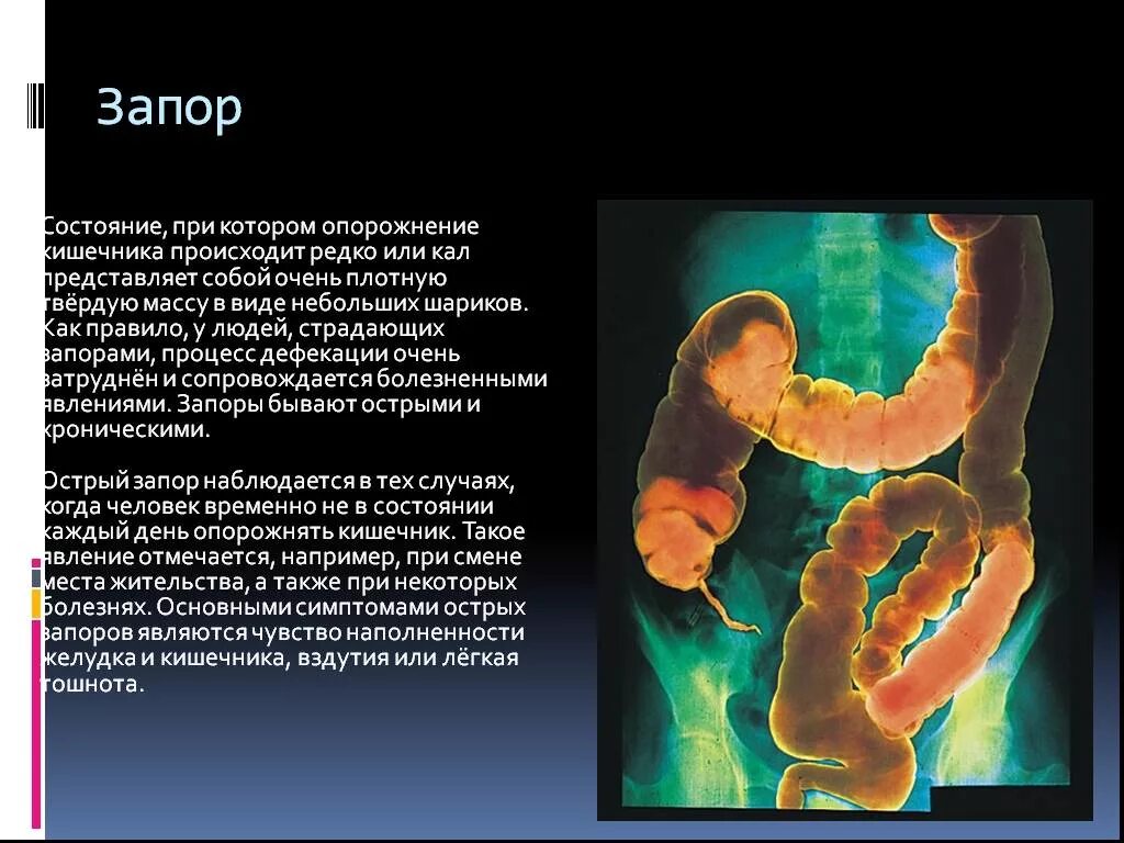 Жжение после опорожнения. Опорожнение прямой кишки.