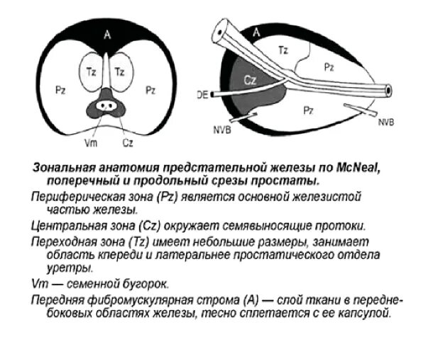 Простату тула. Зональная анатомия предстательной железы мрт. Синдром средней доли предстательной железы. Латеральные доли предстательной железы.