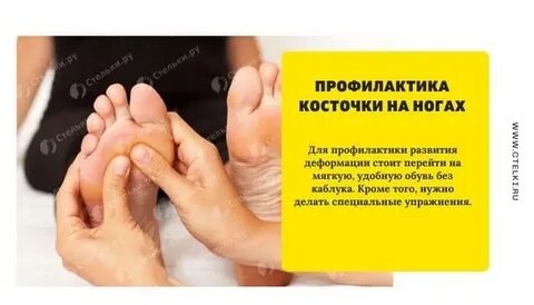 Косточка на ноге причины возникновения