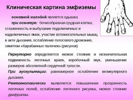 При эмфиземе определяется