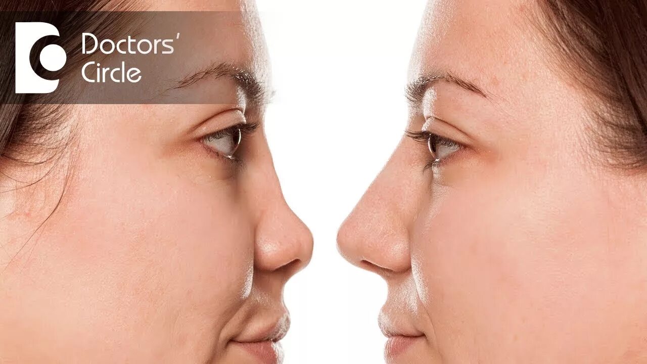 What is a nose. Burun. the nose. nose job.