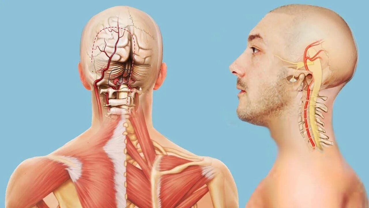 Напряженная спина. Аневризма позвоночной артерии. Остеохондроз хрустит шея. Боль в шейном отделе позвоночника. Остеохондроз шеи.