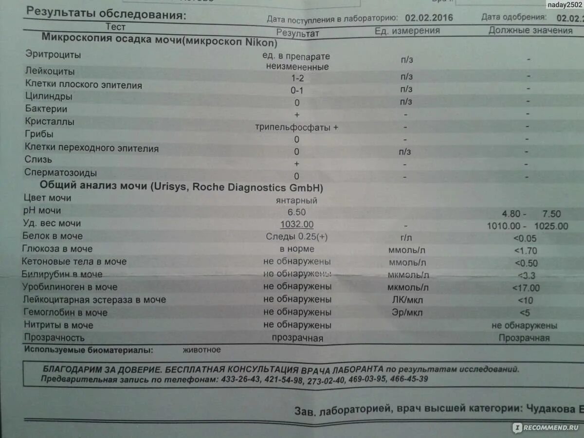 Уробилиноген в моче у мужчины повышены. Норма уробилиногена в моче. Уробилин в моче норма у детей. Уробилиноген в моче норма. Повышение уробилиногена в моче.