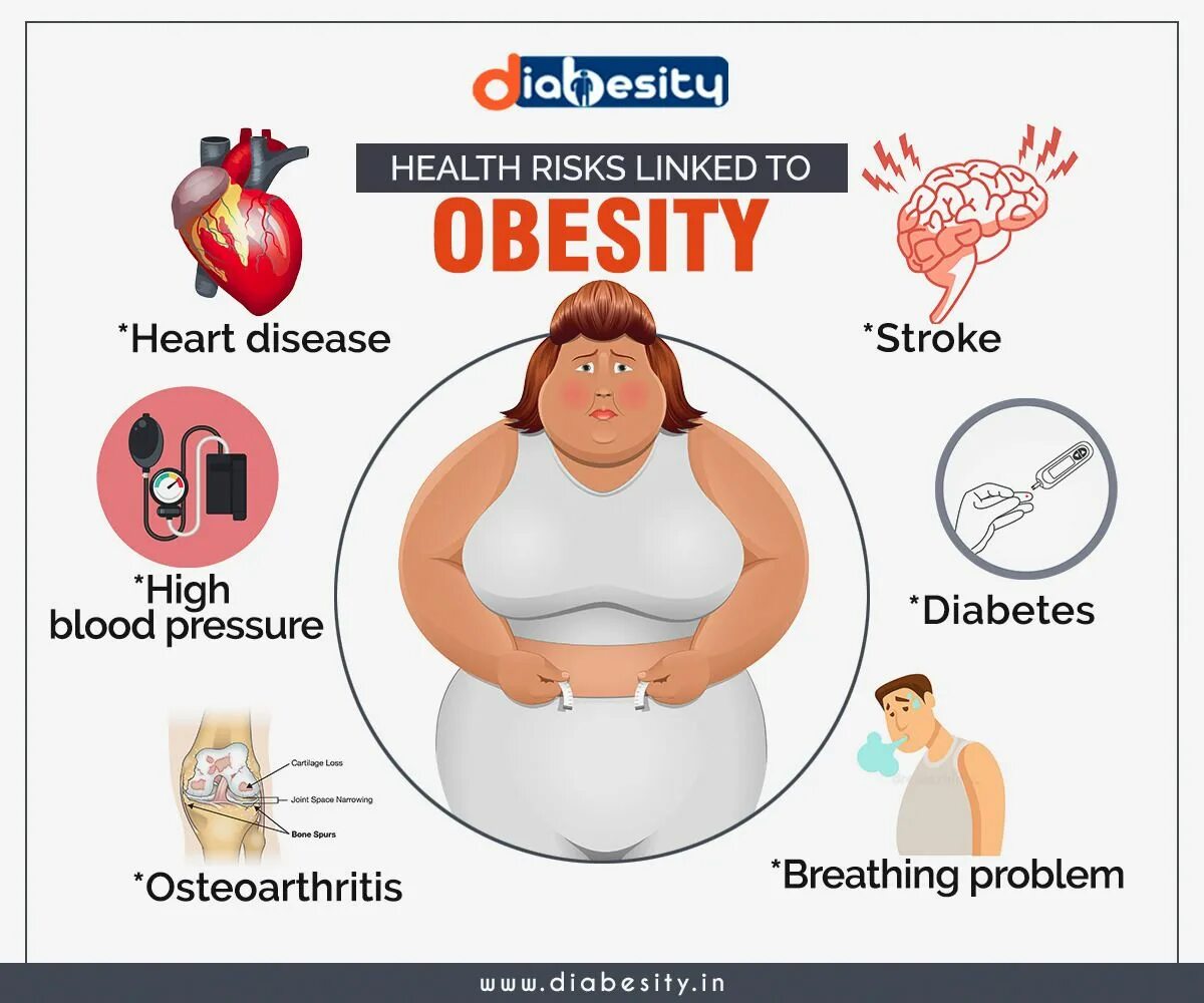 Health risks. Obesity diseases. Risks of obesity. Obesity illness. Obesity & Weight loss.