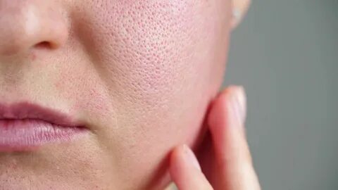 Skin pores