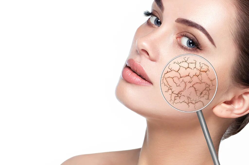Обезвоженная кожа как выглядит. Сухая обезвоженная кожа лица. Кожа обезвоженная и молодая. Сухая обезвоженная кожа лица. Сухая обезвожегная крэа.