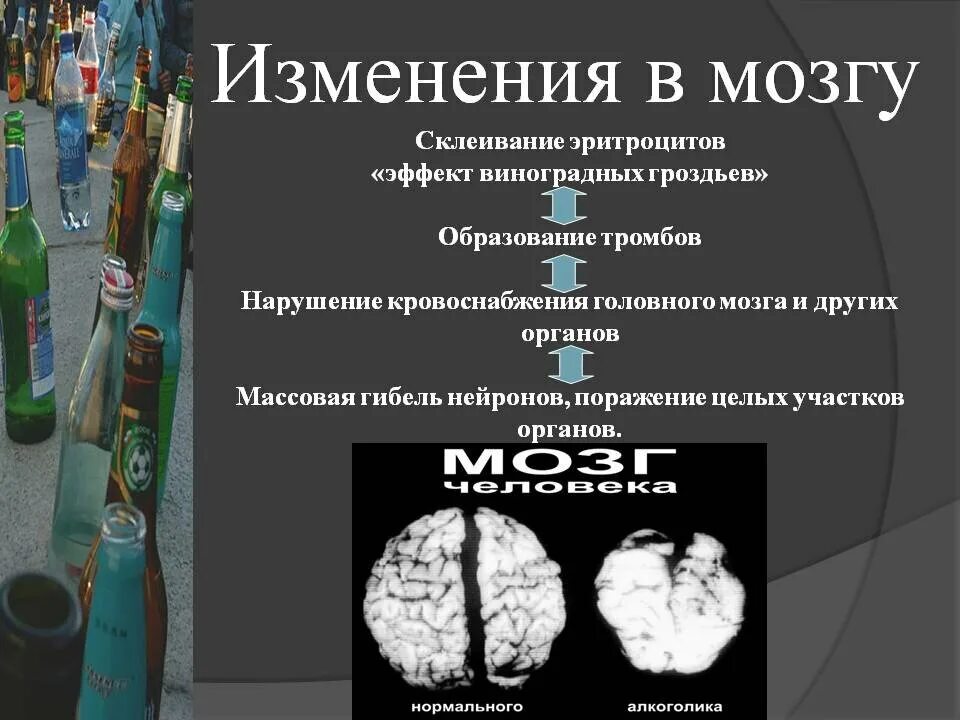 Эффект виноградной грозди алкоголь. Эффет виноградной грозди. Головой мозг алкоголика. Необратимые изменения мозга