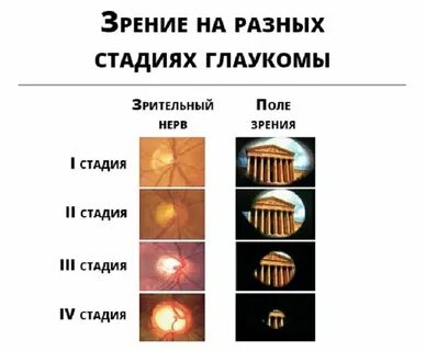 Этапы зрения