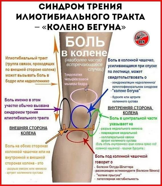 Сильные боли при разгибании колена. Болит колено сбоку с внутренней стороны при. Синдром идиоьибиального тракта. Синдром трения илиотибиального тракта в колене. Болят колени при приседании.