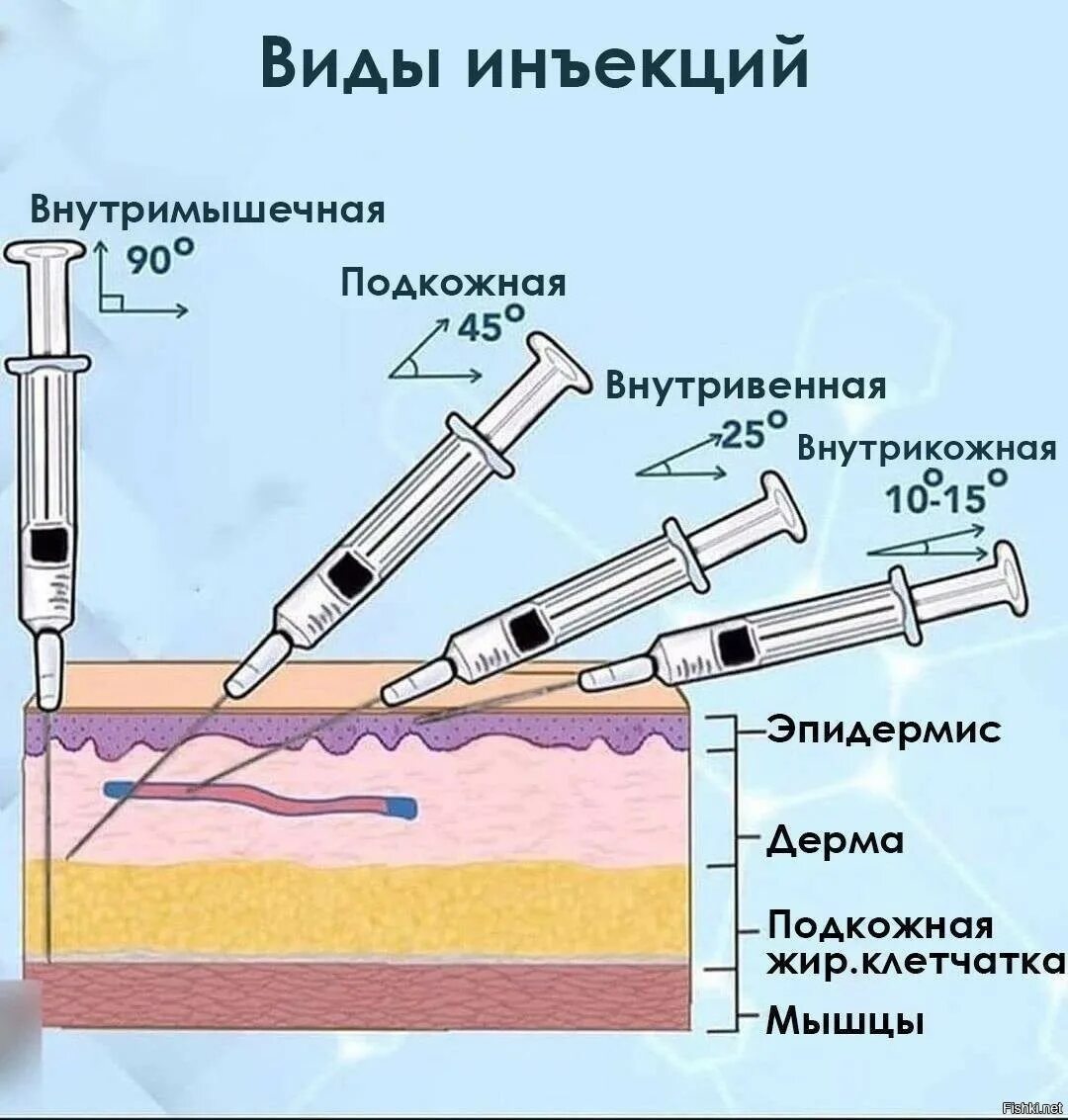 Инъекционная игла длиной 15 мм и сечение. Виды инъекций. Углы введения иглы при инъекции. Внутрикожно и подкожно.