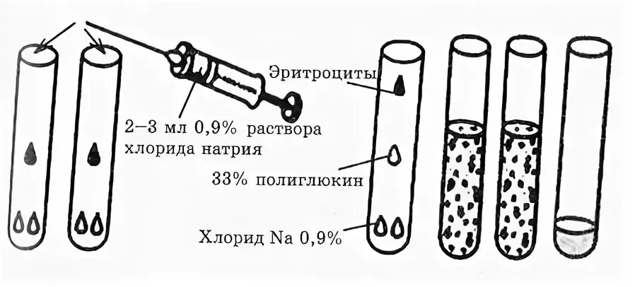 Эритроциты в растворе хлорида натрия. Определение резус принадлежности экспресс методом. Пробирка для крови для определения резус-фактора. Определение резус принадлежности с помощью антирезусной сыворотки д. Определение резус фактора экспресс методом.