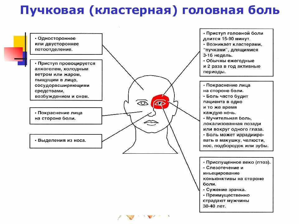 Почему отдает боль в голову. Головная боль локализация. Головная боль схема. Схема локализации головной боли. Схема боли в голове.