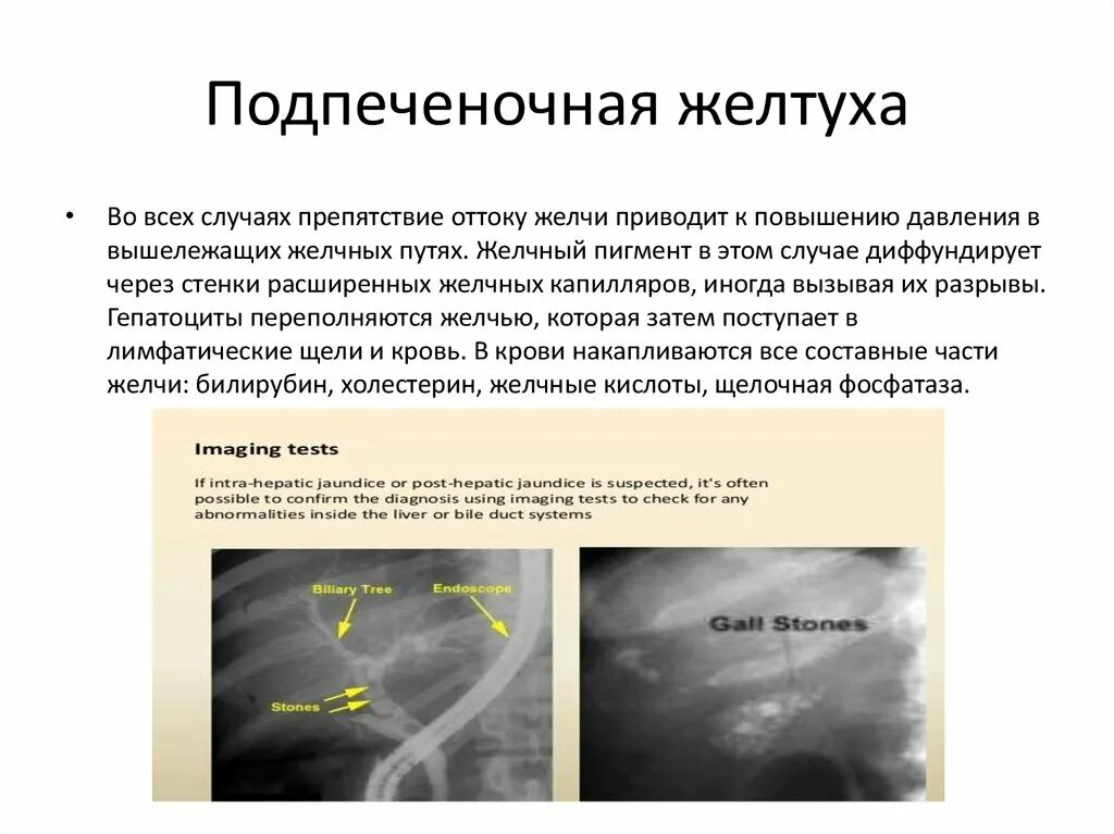 Как увеличить отток желчи