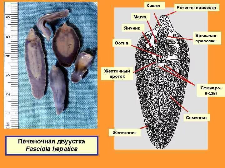 Печеночные сосальщики кишечник. Брюшная присоска печеночного сосальщика. Печеночный сосальщик присоски. Внутреннее строение печеночного сосальщика. Семенники печеночного сосальщика.