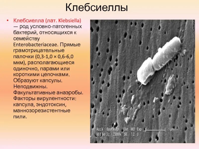 Болезнетворная бактерия 6. Клебсиелла пневмония микробиология. Клебсиеллы морфология. Клебсиелла пневмония характеристика возбудителя.