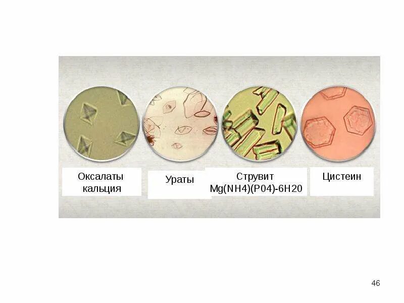 Оксалаты в моче у кота. Струвиты и оксалаты в моче. ураты струвиты оксалаты. кристаллы фосфатов в моче. соли в моче у кота.
