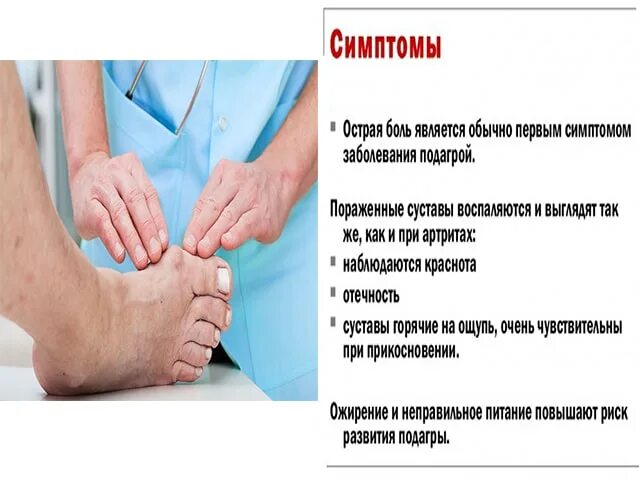Подагра признаки и лече. Симптомы при подагре подагре. Подагра симптомы у женщин на руках признаки. Подагра диета для мужчин. Дебют псориатического артрита.
