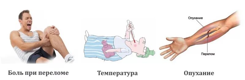 Перелом сильно болит. Симптомы при переломе костей. Симптомы при переломе кости. Симптомы при переломе костей конечностей.