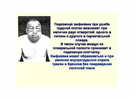 Эмфизема при травме