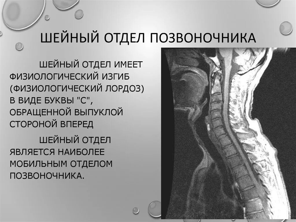 Строение шейного отдела позвоночника. Позвонки шейного отдела. Шейный отдел позвоночника анатомия. Шейный позвоночник строение.