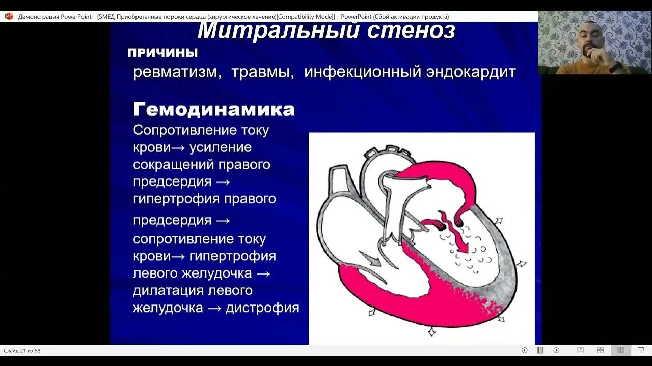 Гемодинамика при стенозе недостаточности митрального клапана. Митральный стеноз гемодинамика схема. Митральный стеноз схема. Изменения при стенозе митрального клапана.