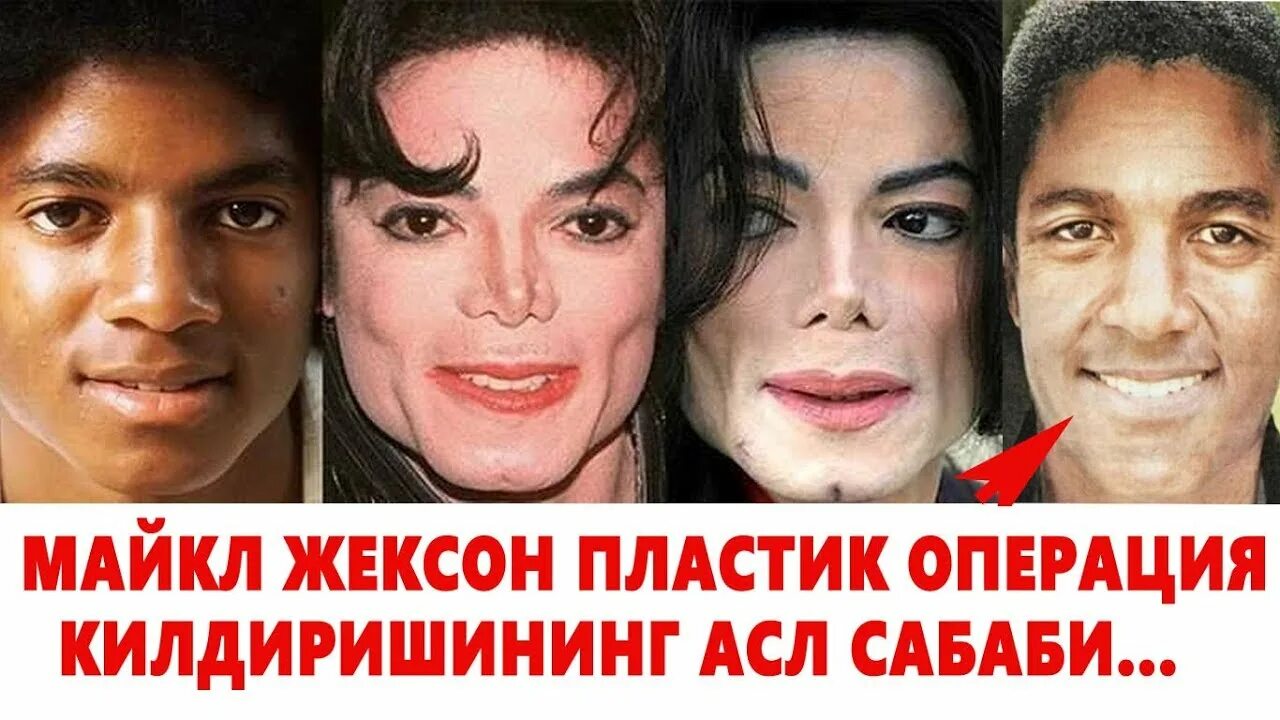 Почему джексон делал операции. Michael jackson до операции.