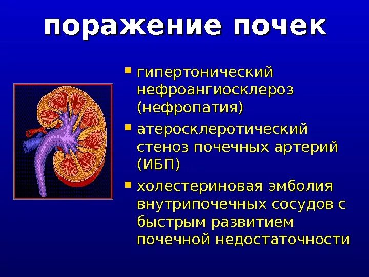 Почечная гипертония
