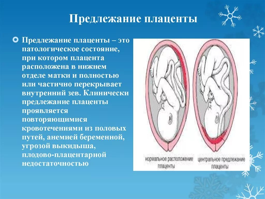 Предлежание плаценты. Краевое предлежание плаценты. Левое прилежание поаценты. Типы расположения плаценты. При низкой плацентации можно